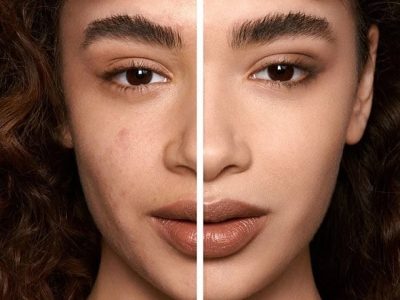 بهترین کرم پودر برای پوست چرب و جوش دار
